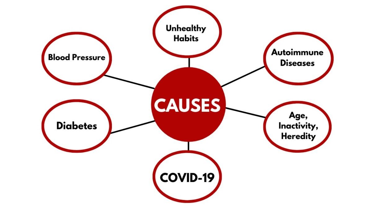 Causes of Heart Attack Causes of Heart Attack
